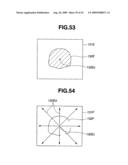 Medical Image Processing Apparatus, Luminal Image Processing Apparatus, Luminal Image Processing Method, and Programs for the Same diagram and image