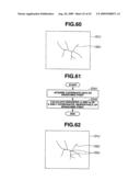 Medical Image Processing Apparatus, Luminal Image Processing Apparatus, Luminal Image Processing Method, and Programs for the Same diagram and image