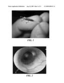 EFFICIENT AUTOMATED UROTHELIAL IMAGING USING AN ENDOSCOPE WITH TIP BENDING diagram and image