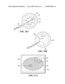 EFFICIENT AUTOMATED UROTHELIAL IMAGING USING AN ENDOSCOPE WITH TIP BENDING diagram and image