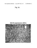 ED-B FIBRONECTIN AS STRATIFICATION MARKER FOR ANTI-TUMOR DRUGS diagram and image