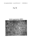 ED-B FIBRONECTIN AS STRATIFICATION MARKER FOR ANTI-TUMOR DRUGS diagram and image