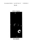 ED-B FIBRONECTIN AS STRATIFICATION MARKER FOR ANTI-TUMOR DRUGS diagram and image