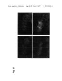 Genetic Products Differentially Expressed In Tumors And The Use Thereof diagram and image