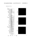 METHOD OF DIAGNOSING ESOPHAGEAL CANCER diagram and image