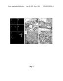 Empty capsids (vlps(-vp4)) of the infectious bursal disease virus (ibdv), obtainment process and applications diagram and image