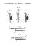 Golf Club Grip diagram and image