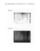 NOVEL USES FOR DRUGS TARGETING GLUTAMINE SYNTHETASE diagram and image