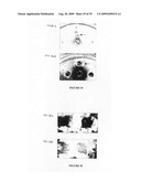 NOVEL USES FOR DRUGS TARGETING GLUTAMINE SYNTHETASE diagram and image