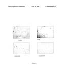 MODULATING ANGIOGENESIS WITH NOD FACTORS SUCH AS GLUCOSAMINE OLIGOSACCHARIDES diagram and image