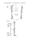 GENE DELIVERY FORMULATIONS AND METHODS FOR TREATMENT OF ISCHEMIC CONDITIONS diagram and image