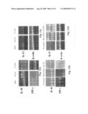 METHODS EMPLOYING AND COMPOSITIONS CONTAINING DEFINED OXIDIZED PHOSPHOLIPIDS FOR PREVENTION AND TREATMENT OF ATHEROSCLEROSIS diagram and image