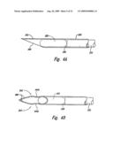 Apparatuses and methods for percutaneously implanting objects in patients diagram and image