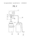 ENDOSCOPIC FLUID FEED SYSTEM diagram and image