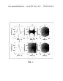 SYSTEM AND METHOD FOR ULTRASONIC IMAGE PROCESSING diagram and image