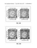 SYSTEM AND METHOD FOR ULTRASONIC IMAGE PROCESSING diagram and image