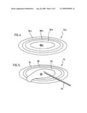 KIT FOR ADMINSTERING A THERAPEUTIC AGENT INTO TISSUE diagram and image