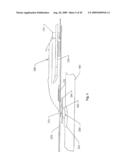 METHOD AND DEVICE FOR DIALYSIS diagram and image