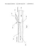 METHOD AND DEVICE FOR DIALYSIS diagram and image