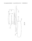 METHOD AND DEVICE FOR DIALYSIS diagram and image