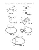 METHODS FOR PERFORMING GASTROPLASTY diagram and image