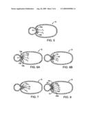 METHODS FOR PERFORMING GASTROPLASTY diagram and image