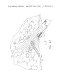 MOTORIZED SURGICAL CUTTING AND FASTENING INSTRUMENT HAVING HANDLE BASED POWER SOURCE diagram and image