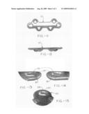 Orthopedic plate for use in the MTP joint diagram and image