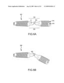 JOINT FUSION DEVICE diagram and image