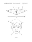 DEVICE FOR THE ELECTROTHERAPEUTIC TREATMENT OF TENSION HEADACHES diagram and image
