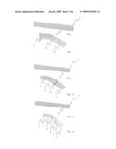 Stent diagram and image