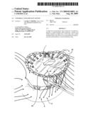 UNIVERSAL ANNULOPLASTY SYSTEM diagram and image