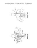 SLOSH CONTROLLED PERSONAL HYDRATION SYSTEM diagram and image