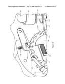 Restraint System diagram and image