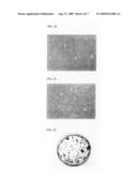 STEM CELL THERAPY FOR THE TREATMENT OF CENTRAL NERVOUS SYSTEM DISORDERS diagram and image