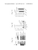 Serum Response Factor and Myocardin Control Alzheimer Cerebral Amyloid Angiopathy diagram and image