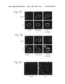 Serum Response Factor and Myocardin Control Alzheimer Cerebral Amyloid Angiopathy diagram and image