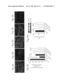 Serum Response Factor and Myocardin Control Alzheimer Cerebral Amyloid Angiopathy diagram and image