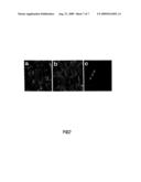 ISOLATED STROMAL CELLS FOR USE IN THE TREATMENT OF DISEASES OF THE CENTRAL NERVOUS SYSTEM diagram and image