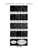 ANKTM1, A Cold-Activated TRP-Like Channel Expressed in Nociceptive Neurons diagram and image