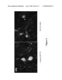 TREATMENT OF CHRONIC PAIN WITH ZINC FINGER PROTEINS diagram and image