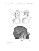 ROBOTIZED INSTALLATION FOR THE POSITIONING AND MOVEMENT OF A COMPONENT OR INSTRUMENT AND TREATMENT DEVICE THAT COMPRISES SUCH AN INSTALLATION diagram and image