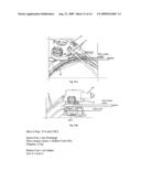 ROBOTIZED INSTALLATION FOR THE POSITIONING AND MOVEMENT OF A COMPONENT OR INSTRUMENT AND TREATMENT DEVICE THAT COMPRISES SUCH AN INSTALLATION diagram and image