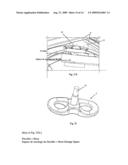 ROBOTIZED INSTALLATION FOR THE POSITIONING AND MOVEMENT OF A COMPONENT OR INSTRUMENT AND TREATMENT DEVICE THAT COMPRISES SUCH AN INSTALLATION diagram and image