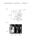 Medical Device Adapted for Detection of Drug Condition diagram and image