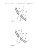 APPARATUS AND METHOD FOR ACCESSING A SINUS CAVITY diagram and image