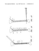 MODULAR SEGMENTED INTRAMEDULLARY SYSTEM, APPARATUS AND METHODS diagram and image