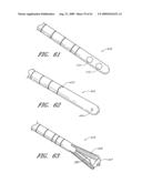 MODULAR SEGMENTED INTRAMEDULLARY SYSTEM, APPARATUS AND METHODS diagram and image