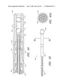 MODULAR SEGMENTED INTRAMEDULLARY SYSTEM, APPARATUS AND METHODS diagram and image