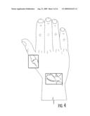 BIOSTAPLES SUITABLE FOR WRIST, HAND AND OTHER LIGAMENT REPLACEMENTS OR REPAIRS diagram and image